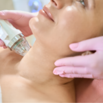Microneedling