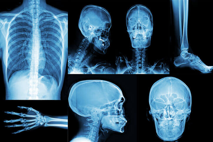 XRay Near Me